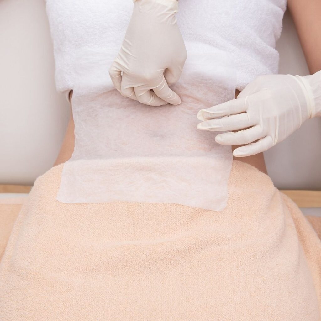 préparation cryolipolyse ventre